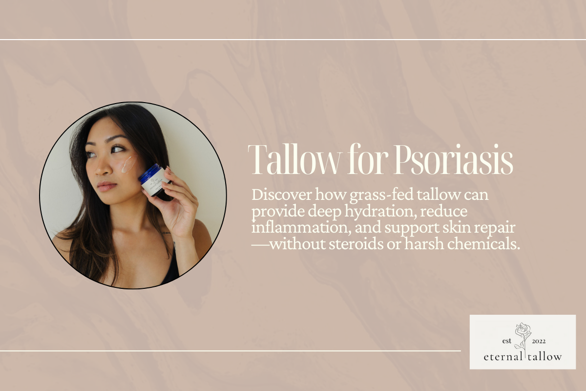 Tallow for Psoriasis: A Natural Solution for Soothing & Healing Skin