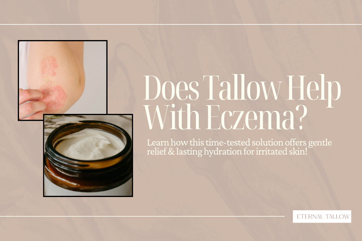 Is Beef Tallow Good For Eczema?