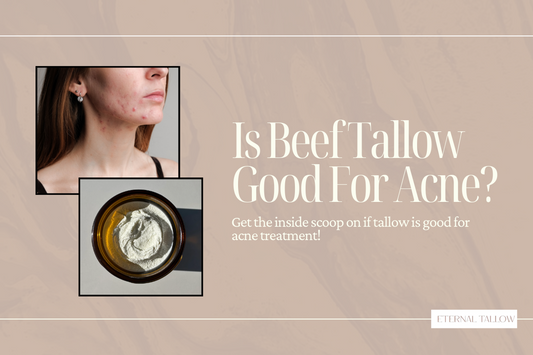 Tallow and Acne: Does Tallow Really Help With Clearing Acne?