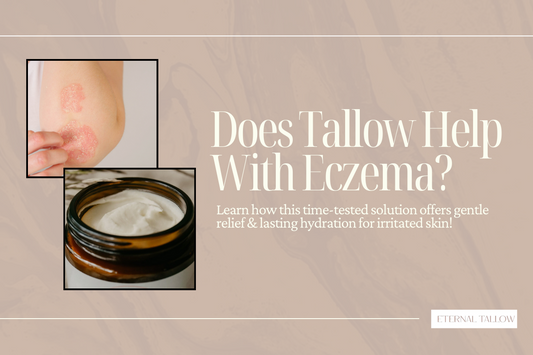 Is Beef Tallow Good For Eczema?